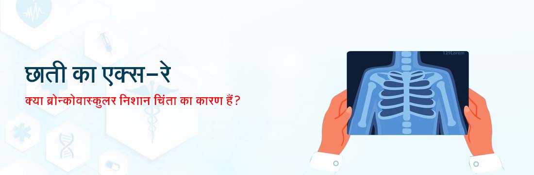 छाती का एक्स - रे: क्या ब्रोन्कोवास्कुलर निशान चिंता का कारण हैं?